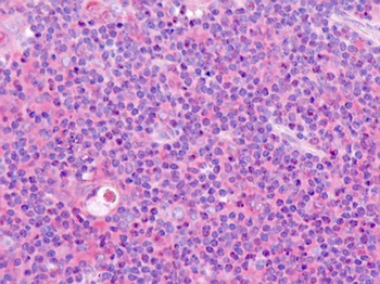 OLFML2B Antibody