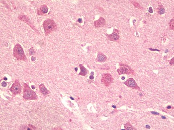 KPNA5 Antibody