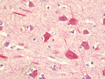 PPHLN1 Antibody