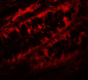 PPHLN1 Antibody