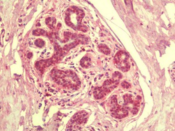 SIK3/QSK Antibody
