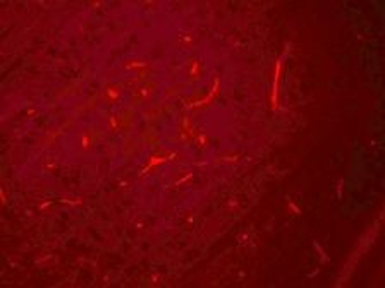 SIK3/QSK Antibody