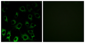 RPS4X + RPS4Y1 + RPS Antibody