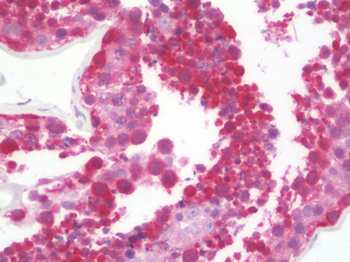 ABHD2 Antibody