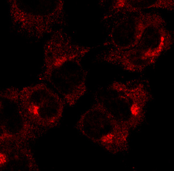 RAB1A Antibody