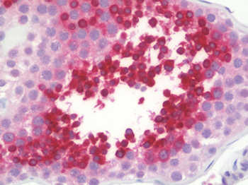 TSTA3/GDP-L-Fucose Synthase Antibody