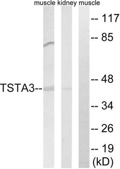 TSTA3/GDP-L-Fucose Synthase Antibody