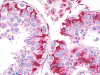 SYNE3/C14orf49 Antibody