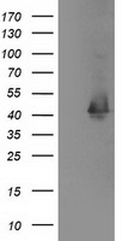 MAPRE2/EB2 Antibody