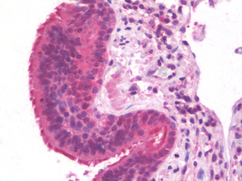 FMR1/FMRP Antibody