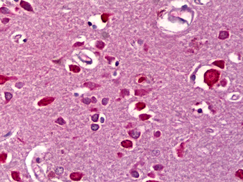 CCN5 Antibody (clone 1E11)