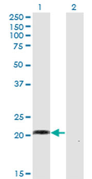 CCN5 Antibody (clone 1E11)