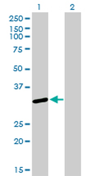 SNRPA / U1A Antibody (clone 3F9-1F7)