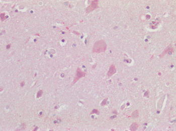 CHRM3 / M3 Antibody (C-Terminus)