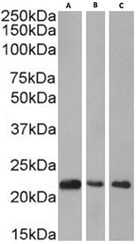 Anti-CBX1 [RAB-C145]