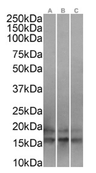 Anti-UBE2C [SAIC-41A-1]