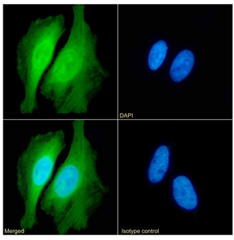 Anti-PRDX2 [SAIC-34B-124]