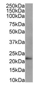 Anti-GSTP1 [SAIC-22D-22]