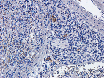 Anti-IL-2R alpha (CD25) [Basiliximab]