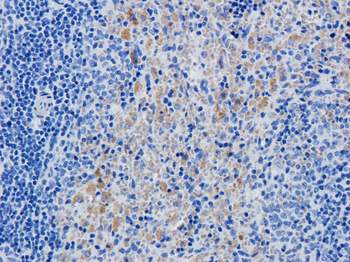 Anti-IL-2R [Daclizumab]