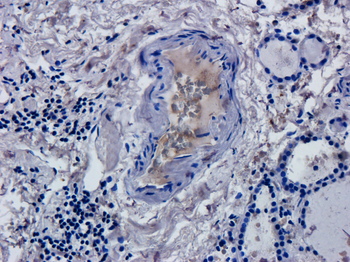 Anti-CD52 [Alemtuzumab (Campath-1H)]