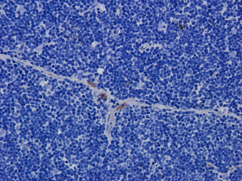 Anti-CD52 [Alemtuzumab (Campath-1H)]