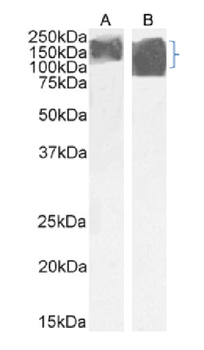 Anti-alpha-gal epitope [m86]