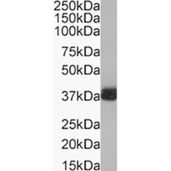Anti-Nerve growth factor [mab 911]