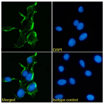 Anti-NMDA Receptor [17]