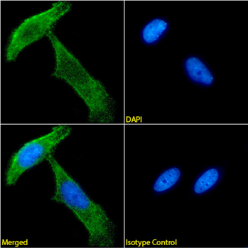 Anti-Neural/glial antigen 2 (NG2) [9.2.27]
