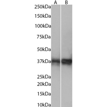 Anti-TCR betaF1 [38C2]