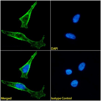 Anti-FOLR1 [Farletuzumab (MORAb-003; M3)]