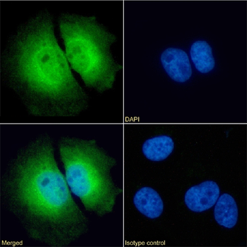 Anti-beta catenin [15B8]