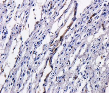 Anti-Tumor associated glycoprotein (TAG) 72 [B72.3 (Satumomab)]