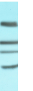Anti-CD4 [CE9.1 (Clenoliximab)]