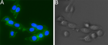 Anti-Human Ephrin Type A receptor 2 [1C1]