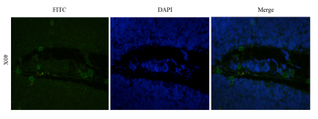 Anti-IL-2R alpha (CD25) [Basiliximab]