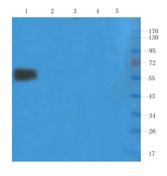 Anti-IL-2R alpha (CD25) [Basiliximab]