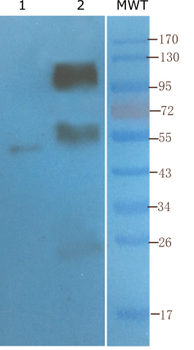 Anti-CD4 [YNB46.1.8 (Campath-9H)]