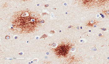 Anti-amyloid beta [6E10]