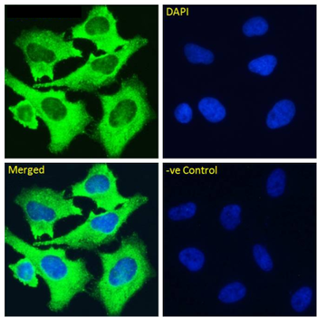 Anti-alpha 5 beta 1 Integrin [M200 (Volociximab)]