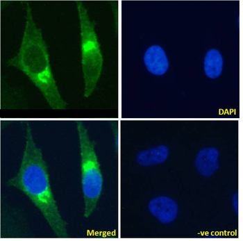 Anti-Beta-2 microglobulin [BBM.1]