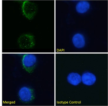 Anti-Glycophorin A M antigen [M2A1]