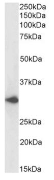 Anti-DARC [2C3]