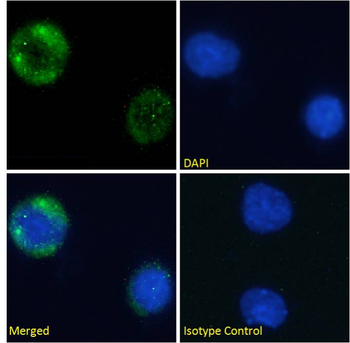 Anti-CD10 [NL-1]