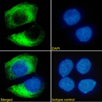 Anti-HER2/neu [SER4]