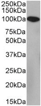 Anti-CD10 [FR4D11]