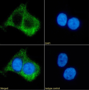 Anti-Beta 2 adrenergic receptor [R11/E1]