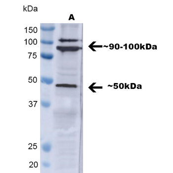 TNF-R1 Antibody