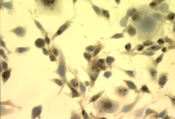 HSP70 Antibody (HRP)